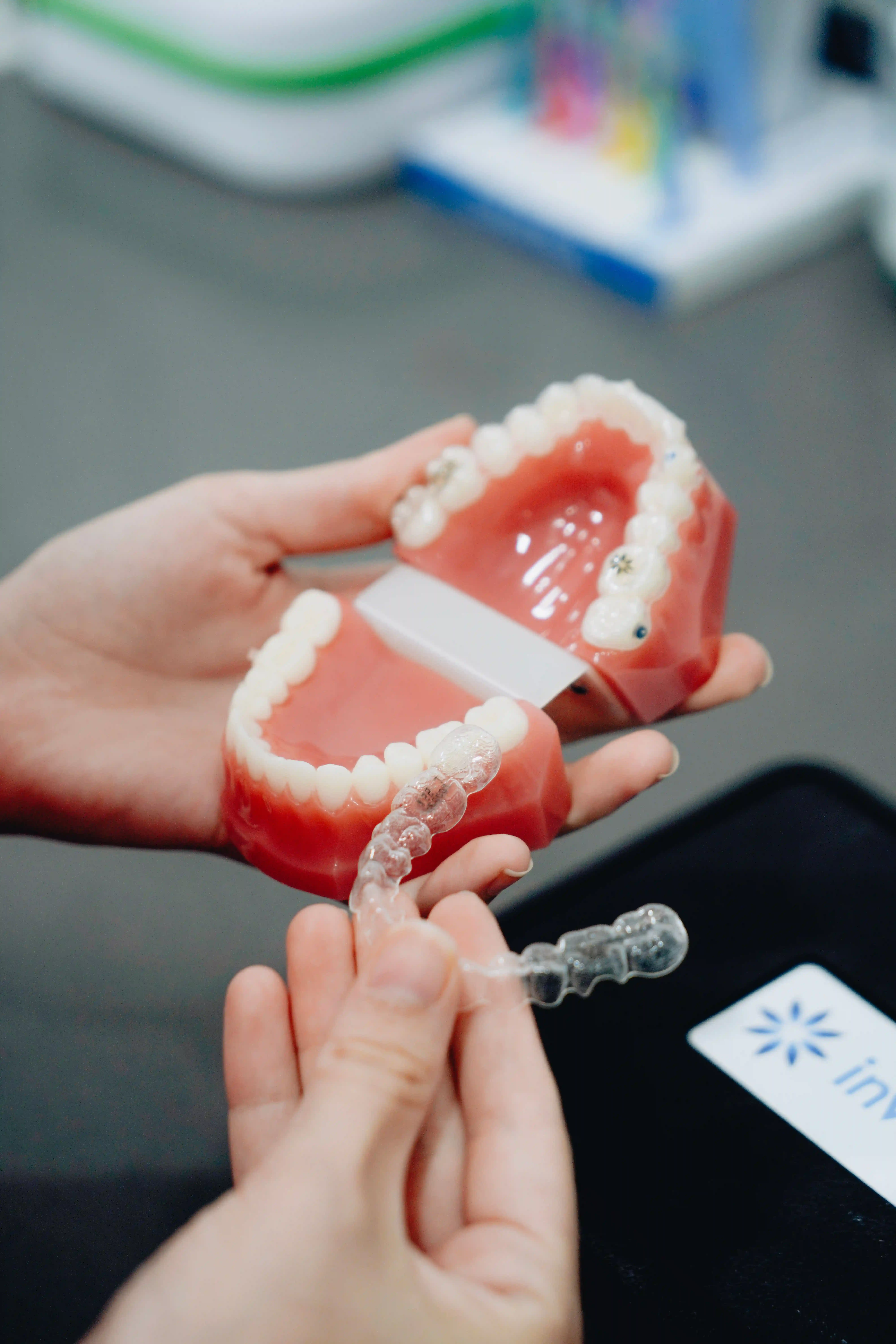 Braces & Aligners